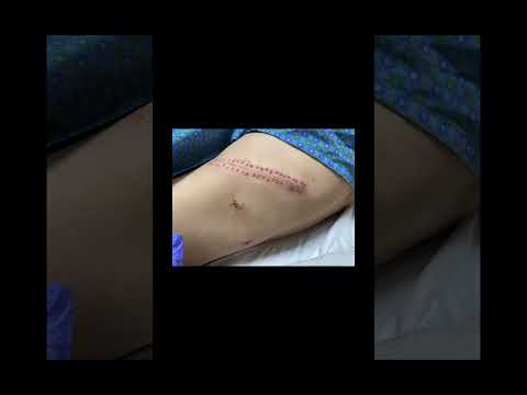 Preview of 2 shots later #music #health #musichelp #fitness #learn #musiclessons #paralysis #motivation #illy